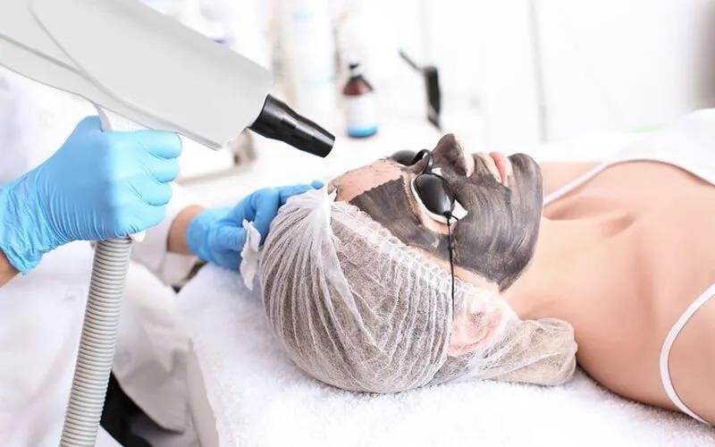 Charcoal Laser Facial