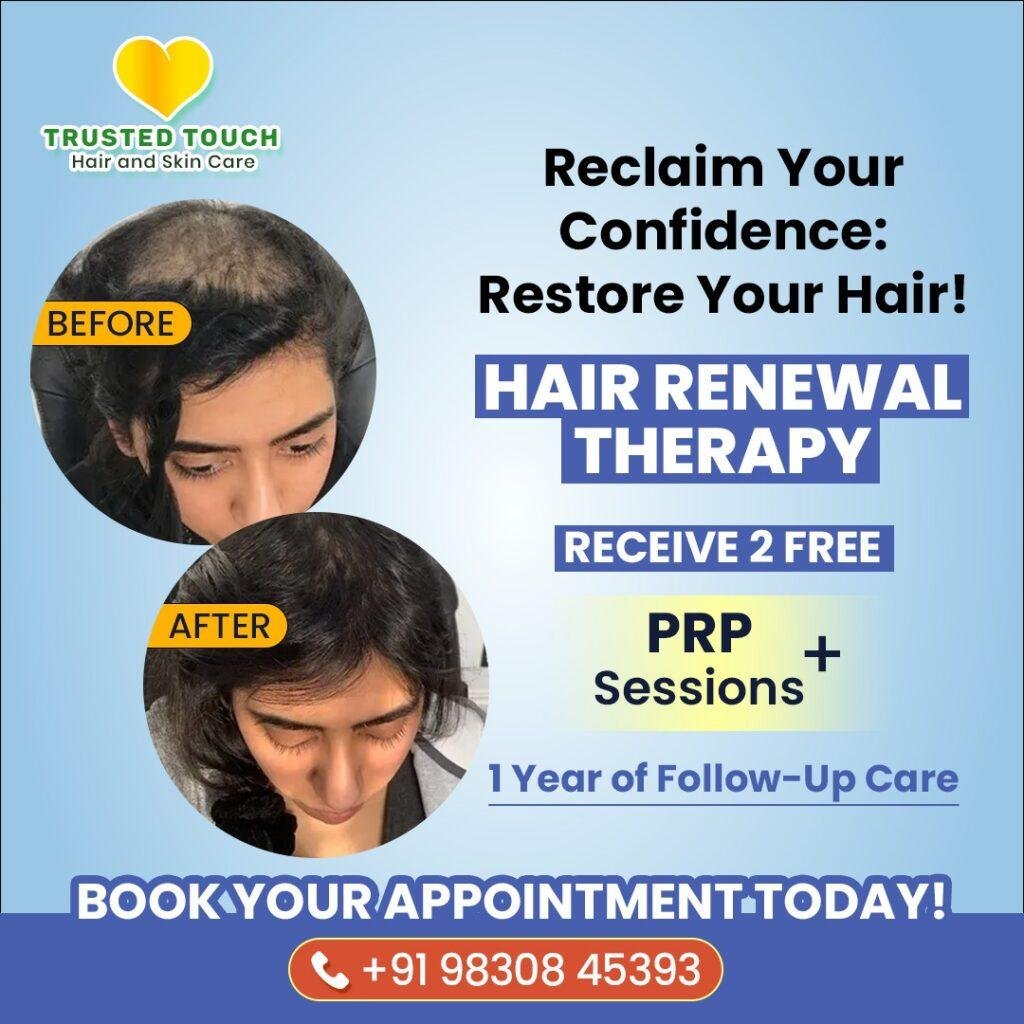 Hair PRP Treatment