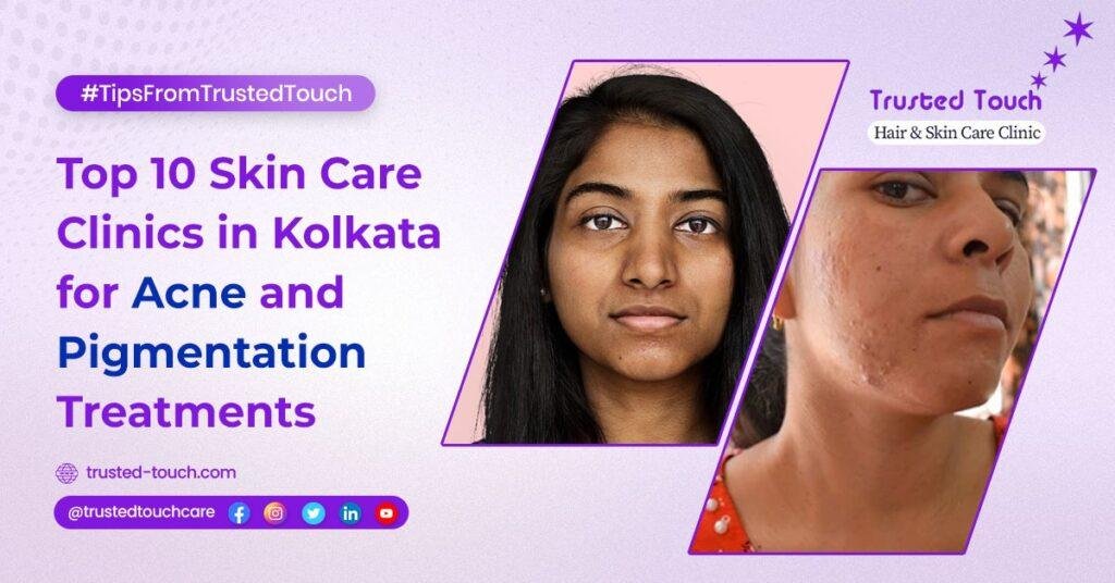 Top 10 Skin Care Clinics in Kolkata for Acne and Pigmentation Treatments<