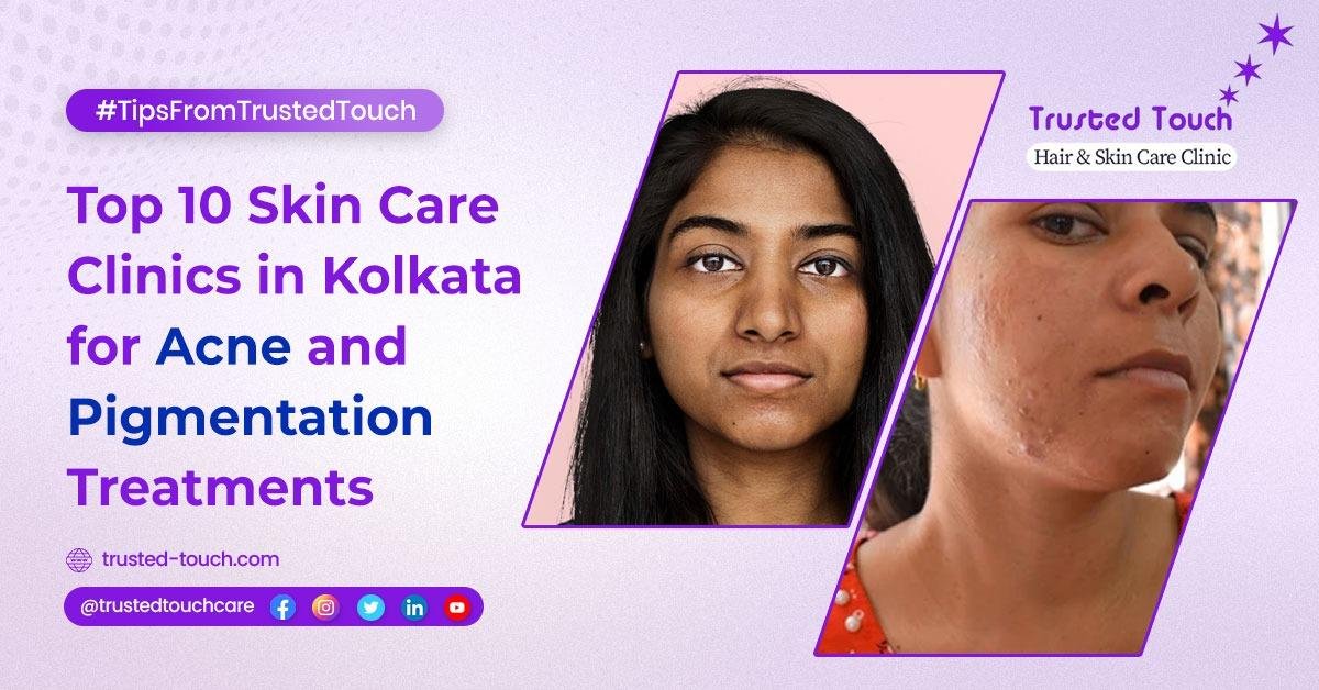 Top 10 Skin Care Clinics in Kolkata for Acne and Pigmentation Treatments